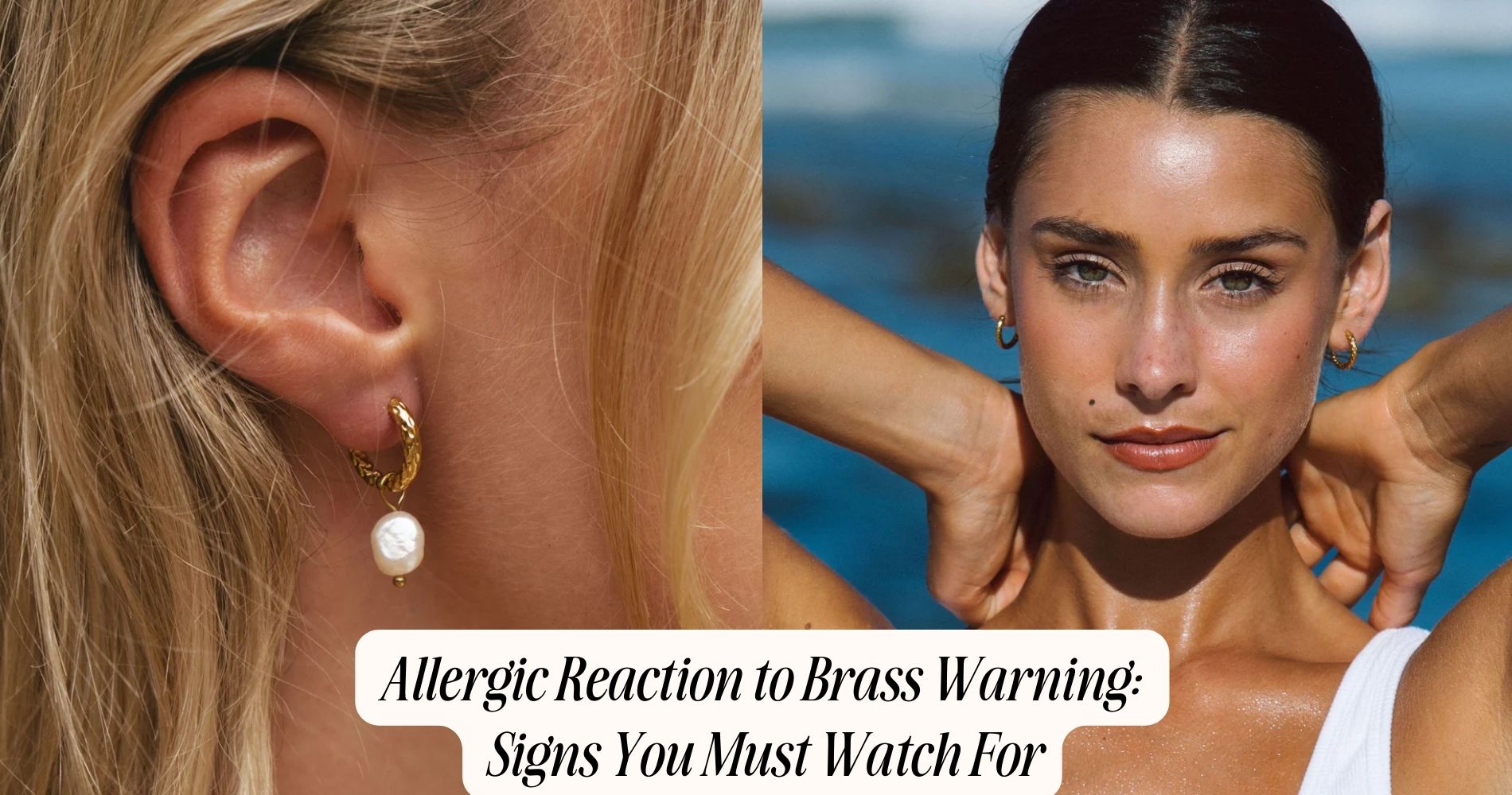 allergic reaction to brass